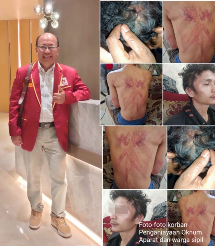 Sebulan Laporan Penganiayaan di Polrestabes Medan Belum Terungkap, Ketua PPN Kota Medan : Polri Punya Keahlian Mengungkap Kasus Ini