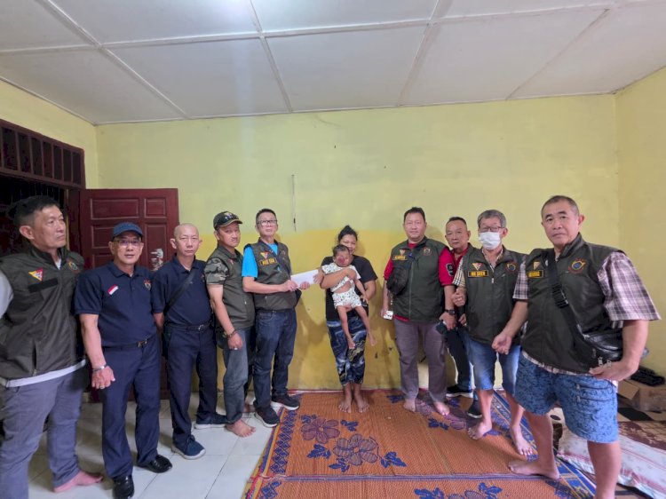 Ketum KISS Akiong Bantu Bocah Penderita Tumor Mata, Wujud Nyata Kepedulian Tanpa Batas